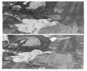 The gruesome crimes of Papin sisters 1933- Forensic photo of the crime scene. The victims were mutilated beyond recognition. Their eyes were gouged out. The police discovered the Papin sisters in their room, naked, in bed together with the murder weapon. from naturist sisters brothersmil aunty undressing sare in room naked hidden caman bus mms sex