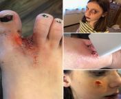 My daughter decided she wants to be a horror movie makeup artist when she grows up! She freaks me out sometimes when she texts me her injuries, shes quite talented and I cant wait to see how she progresses! from qatil chudail horror movie