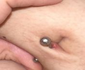 I got my belly piercing in August last year , Ive had problems with it ever since i guess because i sleep on my belly and i think its pierced wrong. Now idk whats wrong with it , does anyone know whats this ? Always no matter how much i clean it , it s from belly stab in serial