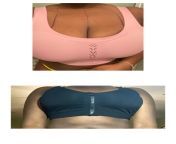 Before and After 11 days PO 36 H/I to a 36D So happy with my results! from shailesh mehta and madhvi bhide porn po