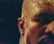 A close-up of the injury to the right ear of Evander Holyfield after Mike Tyson bit off a piece of it in the third round of their World Boxing Association Heavyweight title fight on 28 June 1997 (Las Vegas, Nevada 1997) [2867x2153] from canal oprawa 1997