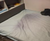 My eczema is so bad, that after sleeping on clean bed sheets for 3 days, this is the blood stain that was left behind. from brother fuck sleeping sister clean pussy