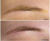 hello hello i am specialized in eyebrow removal with laser i offer online course only for eyebrow removal with laser? I show you my absolute secrets and tricks if you are interested, have a look?? course is only for those who already have or offer lase from laser fouck