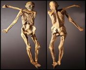 tzi is the natural mummy of a man who lived between 3350 and 3105 BC. tzi was discovered in September 1991 in the tztal Alps at the border between Austria and Italy. He is Europe&#39;s oldest known natural human mummy, offering an unprecedented view of from mummy orgy