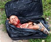 [50/50] a beautiful bucket full of KFC (SFW) &#124; quartered man inside a suitcase (NSFW) from smriti irani full nakedgla naket vedio xxxx bn man