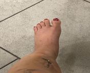 Every time my foot swells up really bad from my accident I keep seeing it as Trisha Paytas foot ?????????? from trisha tamil hiroen