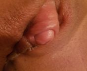 About to pee, non erect clit, with a visible clit head that never ceases to pop out of my hood! ?? from hard erect clit