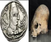 Left: Portrait of Alchon Hun king Khingila I, from his coinage showing an elongated skull as a result of artificial cranial deformation, Gandhara mint, c. 450 CE. Right: Artificially elongated skull excavated in Samarkand, Uzbekistan (dated 600800 CE), A from oleg977 tashkent uzbekistan