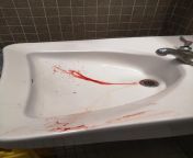 Some guy bled so much in the APM bathroom, facilities management had to call a hazard squad from bled studens