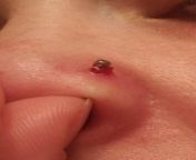 3 week old nose piercing issues from katiecakey katiecakey patreon nude leaks 3