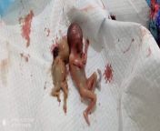 [NSFW] The two killed fetuses in the attack on hindu Bheel homes , Pakistan 13-6-2020. from bheel bhopa