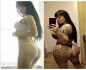 Worlds fattest Vagina woman before and after plastic surgery from naked woman before and after weight loss jpg
