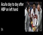 The picture on MLB.coms Ronald Acua injury story is . . . questionable. from myanmar com s