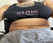 Do you think a paralyzed navel is sexy? from belly navel oute sexy fuck