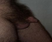 Smaller than average adult male penis with full beard of pubic hair from male penis postmortem