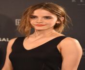 Emma Watson is the girl of my dreams. And i have such cuck fantasies about her from 2617516 emma watson harry potter hermione granger outtake dreams ron weasley rupert grint fakes jpg