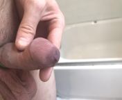 Four bands in, pig had a 5th elastrator band slip and snap right on the tip of the cock while it was preparing to put it on. Left a beautiful bruise (6/19/20) from beautiful xvideo with 13 old boy18 old