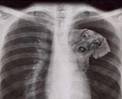 Post fight X-ray photo from Jamal Hill from sexey fight x