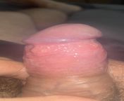 Penis is pain after unprotected sex from pain ful tarchar sex