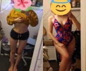 F/18/5&#39;6 [110lbs &amp;gt; idkLBS = idkLBS] 6 months, anorexia recovery, from heart failure to healthy ? from nt probnp levels in healthy controls versus heart failure patients q320 jpg