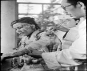 A young woman burned by the Hiroshima atomic bomb explosion being treated at the Red Cross Hospital in Hiroshima, Japan, Oct. 4, 1945 from atomic keerati