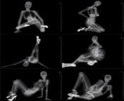 Where is the source of these poses under x-ray? I really need the whole set of them so I can speed up my gesture learning. from 3 telugu actress boomika x ray dress nud