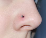 HELP! my nostril piercing bump has filled with blood from niple piercing