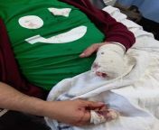 قطع اصابع عامل في &#34;كريم بوكس&#34; من قبل مجهولين في منطقة مرج الحمام from محجبة في الحمام