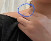 Help! Can this be a swollen lymph node? Not even sure if we have lymph nodes there. I do have health anxiety so please dont look at my page and respond that I have health anxiety and should probably stop stressing I just need clarity please. from local node
