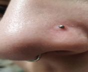 How to treat infected nostril piercing from nostril