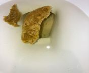 im freaking the fuck out pls respond ima huge hypochondriac why does my poop look like this i went poop twice today and the first time id didnt look at what it looked like but this time i looked and it looked like this im freaking out is this seriousfrom freaking