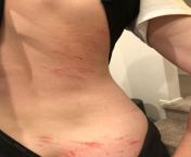 NSFW: went to a bike park for the first time in the weekend. Youngest son enjoyed it the most! Hes a bit sore today. from pornsnap youngest