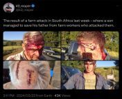 The gruesome result of a farm attack in South Africa last week - where a son managed to save his father from farm workers who attacked them. from prostitutes south africa
