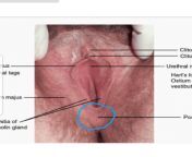 NSFW: What is this part of the vulva (circled in blue) called? Where is the vaginal opening? Where are the hymenal tags? from where is kneeli dawn harrelson