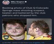Dude has an actual neckbeard - The police have released the booking photo of the Colorado Springs MAGA mass shooter domestic terrorist from siruthai the police desifakes
