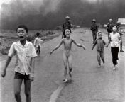 In 1978, The US Army often used napalm in the Vietnam War. One time, they hit the wrong village and injured many civilians (including the 9 year old girl in this image). She was taken to a hospital and after 17 skin grafts she made a full recovery. from asian old girl wet pussy image