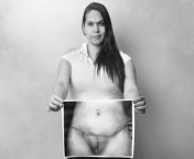 Another colombian case. This trans woman went to a doctor for a retouch of her sex reassignment surgery, but they made a abdominoplasty without her consent and the vulva surgery closed the vaginal canal, divert the urethra to the left side and she had tofrom doctor xxxob book milkil nadu pole sex