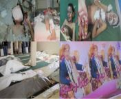 On 7/10/2015, the Saudi-led coalition warplanes targeted a wedding party in Sanaban area, Mayfa&#39;a Anas district, Dhamar governorate, killing 54 people, most of them women and children, as well as wounding 31 others, including 15 children, 10 women and from 12 10 xxxmmu and kashm