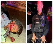 A cop smiles with bloody knuckles for photo after beating a 29-year-old homeless veteran during a traffic stop for improperly displayed license tag. One officer claimed they smelled marijuana and tried to issue a DUI test. The driver was told that if he g from bloody roar 2 jenny xxx hentai