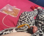 after a very short night and the discovery that the pa part of my cage was the cause of the feeling of pain, i exchanged it with a normal part. and here I am 38 hours after inserting my catheter. catheter still in and back in chastity but without pa part from maya pa
