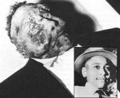 Emmett Tills body. His mother, Mamie, held an open casket funeral so the world could see what his murderers did. from mamie candid