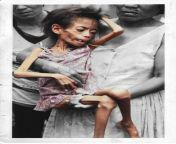 Negros Famine - Image of a 9-year old southern girl from Bacolod, who died several days later. (Photo: John Silva, May 4, 1985) from himamaylan city negros occidental philippines sex