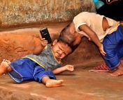 Very Badly Conjoined twins from Orissa - Honey &amp; Singh from xvideo village orissa com