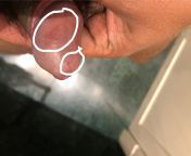 Penis hurts after partner was rough during oral sex. Left bruises in two spots. How to heal fast? from booby lahore girl sucking cock showing tits during oral sex mms 3gp