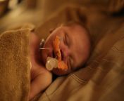 Our baby died in childbirth and we werent able to get any photos of her without the medical equipment. Can you remove the medical equipment from the photo and have her mouth closed? Also reduce puffiness in left eye please. Will tip! Thank you. from childbirth series
