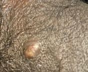 I want to ask if I have a STD, this is on my penis, I have an appointment tomorrow, and only had sex recently with a i met 2 days ago, before this I didnt have sex for at least 7months from only punjab sex ka