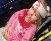 5yo girl bloodied after a riot police attack in Belarus on August 11th from 5yo girl s