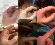 Not the most gross thing, but interesting. Cut my finger open with serrated blade, shows healing process over 6 weeks. from garry gross 11esita xxxiptuero 001 jpgsvpurenudism jpgtamilsexpotosisha keskar open