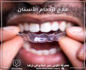 علاج ازدحام الأسنان بالتقويم الشفاف وخيارات التصحيح الأخرى مع مركز بيمارستان الطبي from ازدحام