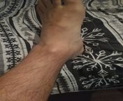 Boyfriend&#39;s ankle developed a grape-size lump. Hurts when pressed and when foot is flexed. from view full screen moaning desi gf when niples pressed and tickled mp4